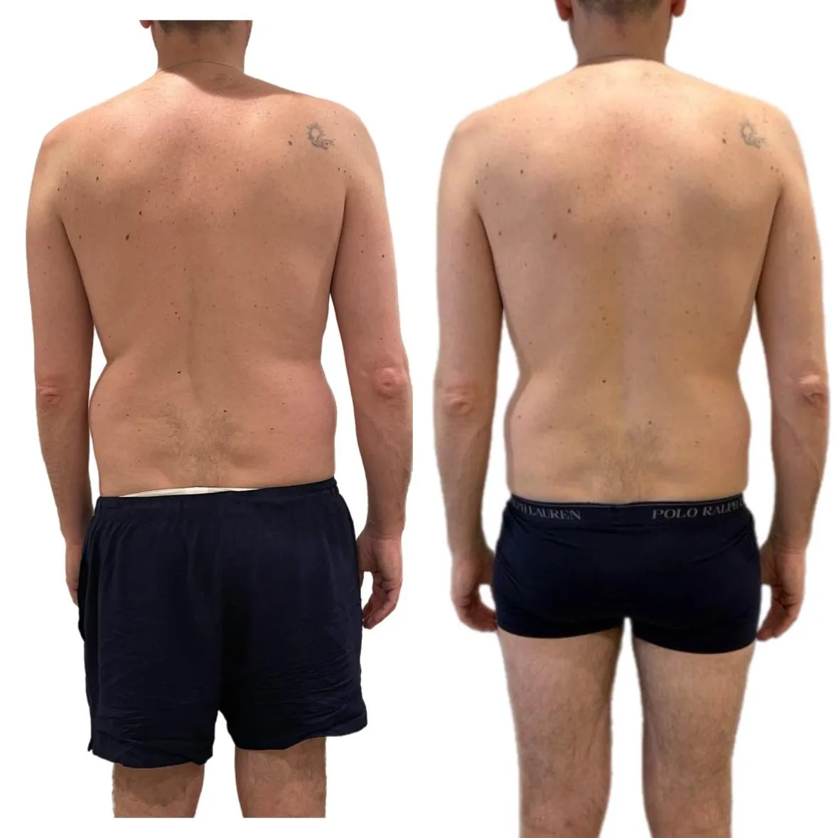 Transformación de José Andrés: reducción del perímetro abdominal y corrección de escoliosis entrenando en casa